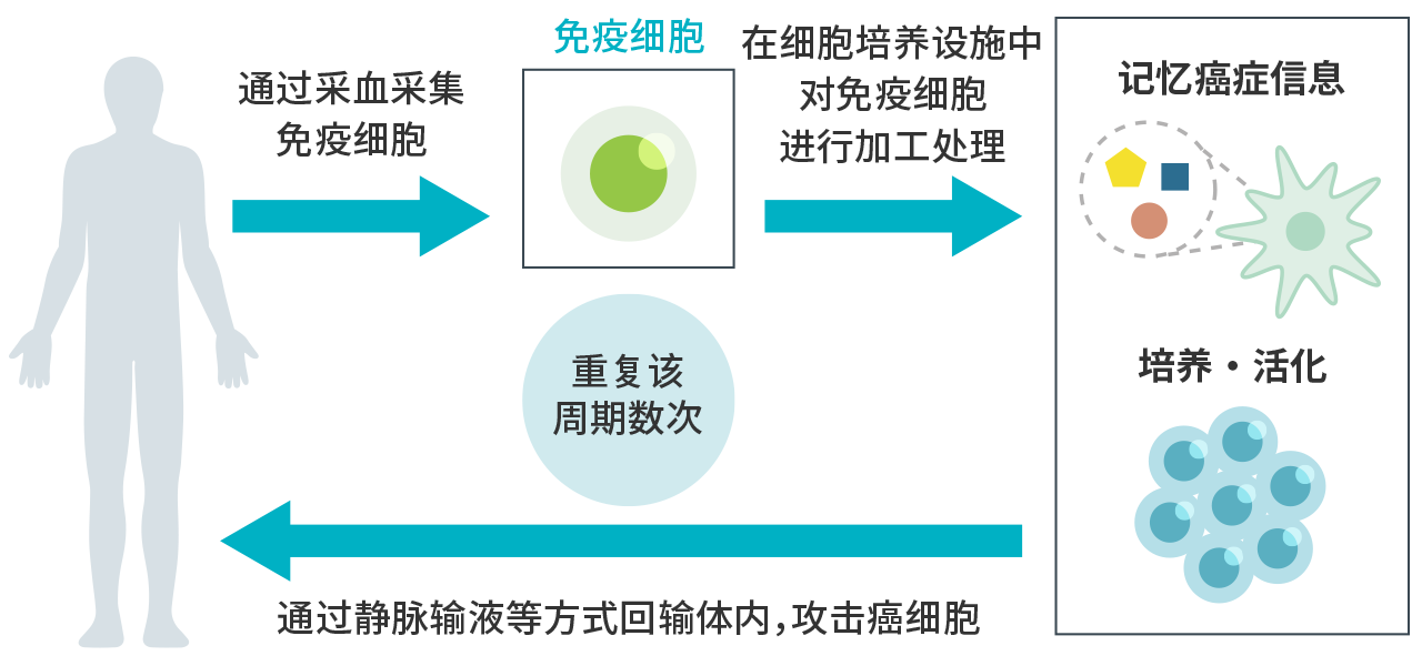 通过采血采集免疫细胞→【免疫细胞】→在细胞培养设施中对免疫细胞进行加工处理→记忆癌症信息（培养・活化）→通过静脉输液等方式回输体内，攻击癌细胞／重复该周期数次