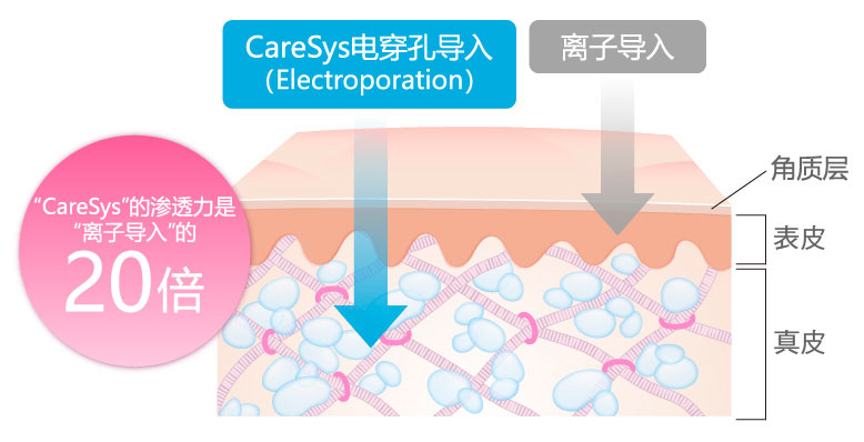 CareSys电穿孔导入（Electroporation）