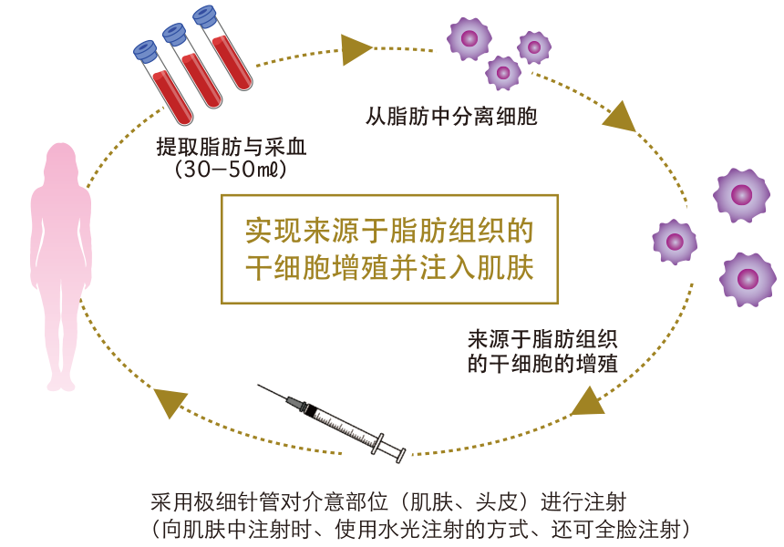 实现来源于脂肪组织的 干细胞增殖并注入肌肤 / →从脂肪中分离细胞→来源于脂肪组织的干细胞的增殖→采用极细针管对介意部位(肌肤、头皮)进行注射(向肌肤中注射时、使用水光注射的方式、还可全脸注射)→提取脂肪与采血(30−50㎖)